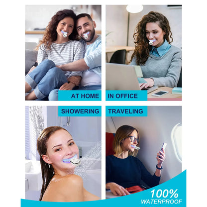 Toothrise™ Pro LED Teeth Whitening Kit – Reveal Your Brightest Smile