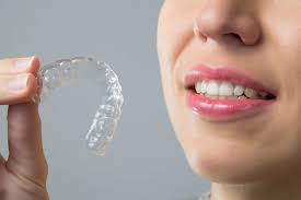 Invisible Dental Aligners – Comfortable Teeth Straightening
